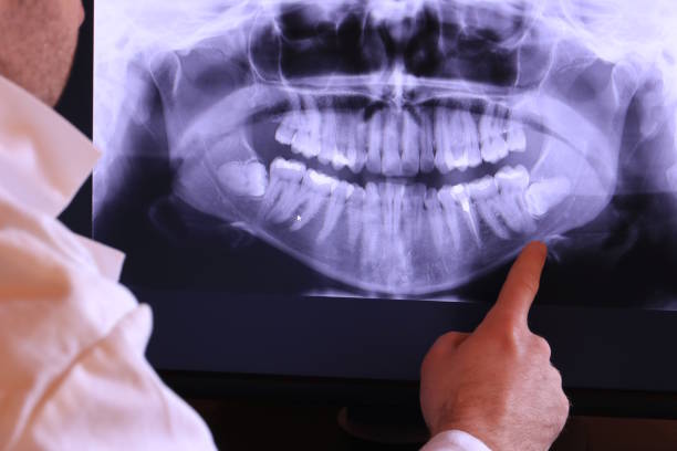 Best Emergency Care for Gum Disease in Rockwell, AR